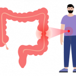 drazdivy tracnik priznaky