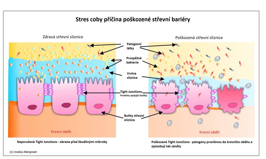 syndrom zvysene propustnosti strev obrazek 1024x614 1
