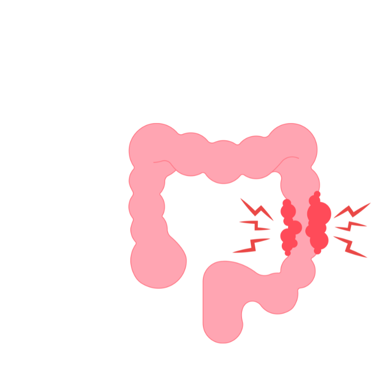 syndrom drazdiveho tracniku cz
