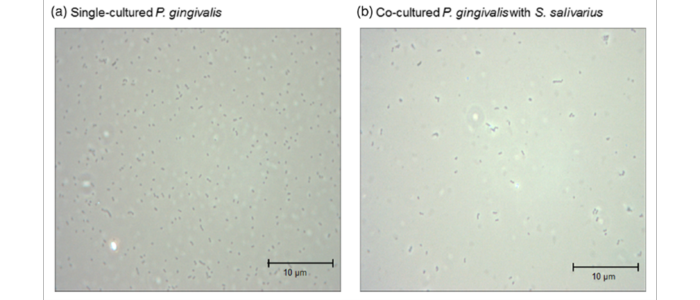 Studienergebnis zeigt, dass Streptococcus salivarius K12 das Wachstum von P. gingivalis hemmen kann, welches v.a. für mundgeruch bekannt ist