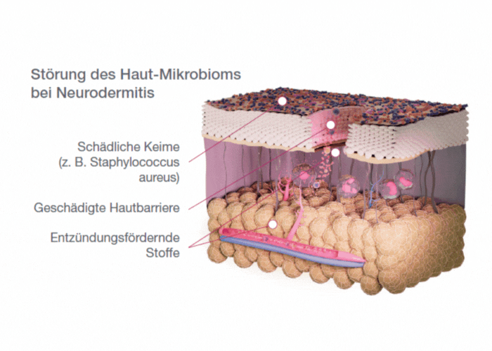 Multispezies-Probiotika wirken gezielt auf das Haut-Mikrobiom