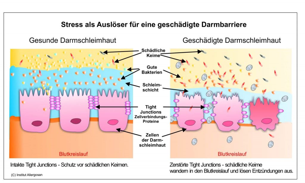 grafische Darstellung einer gesunden Darmschleimhaut versus eine geschädigte Darmschleimhaut