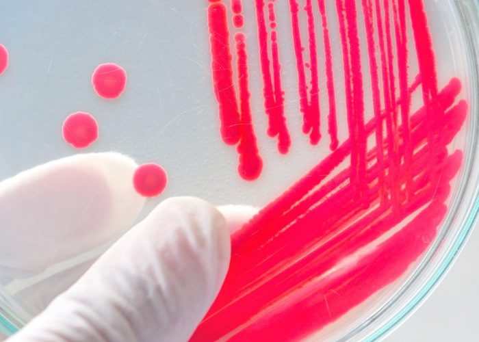 Antibiotika und Wundheilung - Petrischale für das Wachstum von Bakterien