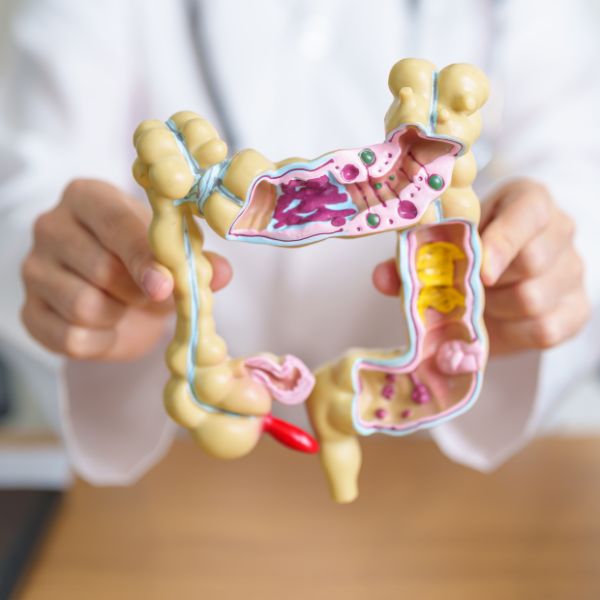 arzt hält darm-nachbau in der hand, sodass man in den darm sieht