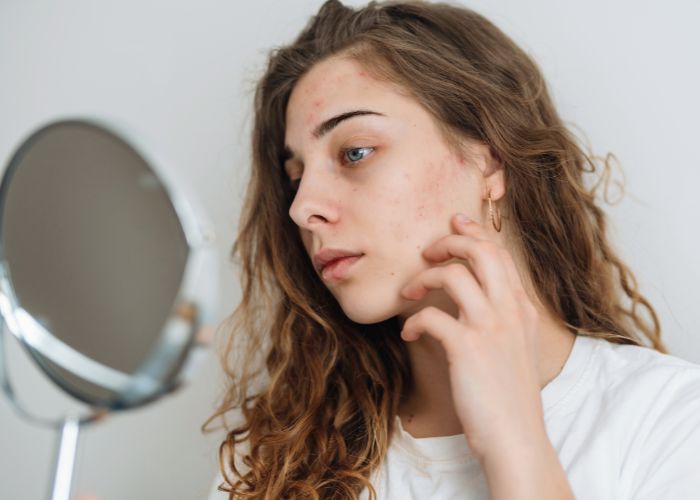junge frau betrachtet gesicht im spiegel - hat mit hautproblemen zu kämpfen