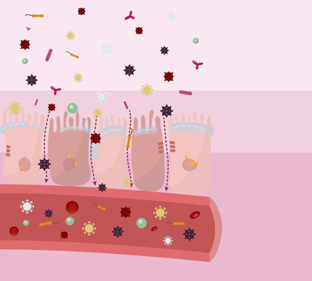 Kranker Darm 3 Schichten