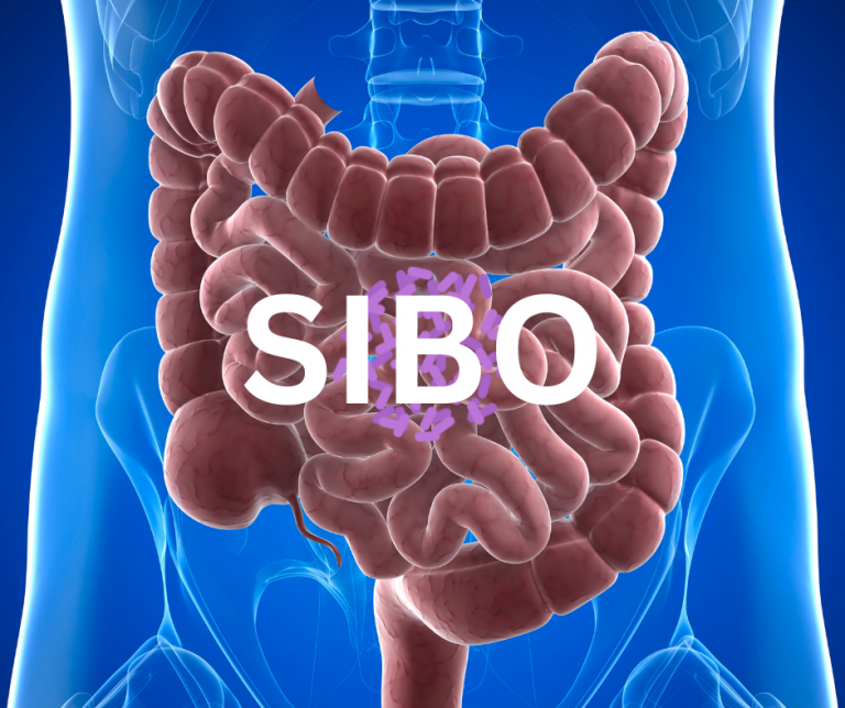 intestino con SIBO resaltado y bacterias sobre el intestino delgado