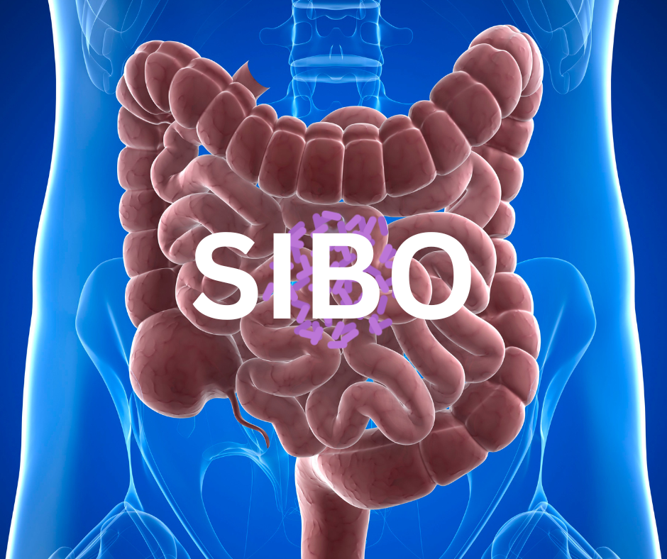 intestino con SIBO resaltado y bacterias sobre el intestino delgado