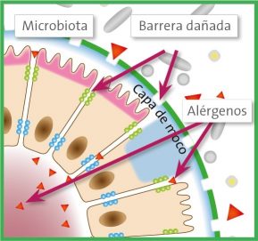 alergia-origen-barrera intestinal dañada-2