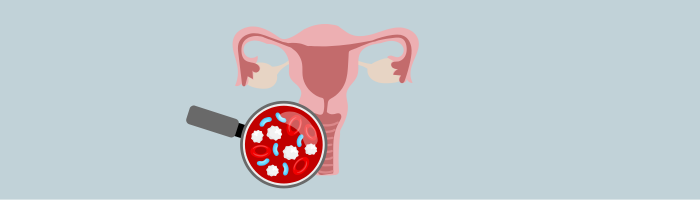 La mycose vaginale : cause, symptômes, traitements