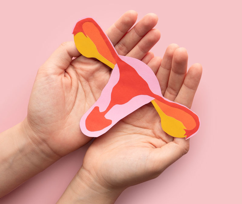 SOPK ou syndrome des ovaires polykystiques : c'est quoi ?