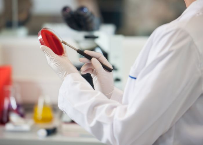 Comment bien choisir un probiotique ? Comment reconnaître un bon probiotique ?