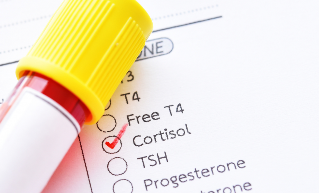 Cortisol élevé : que faire ?
