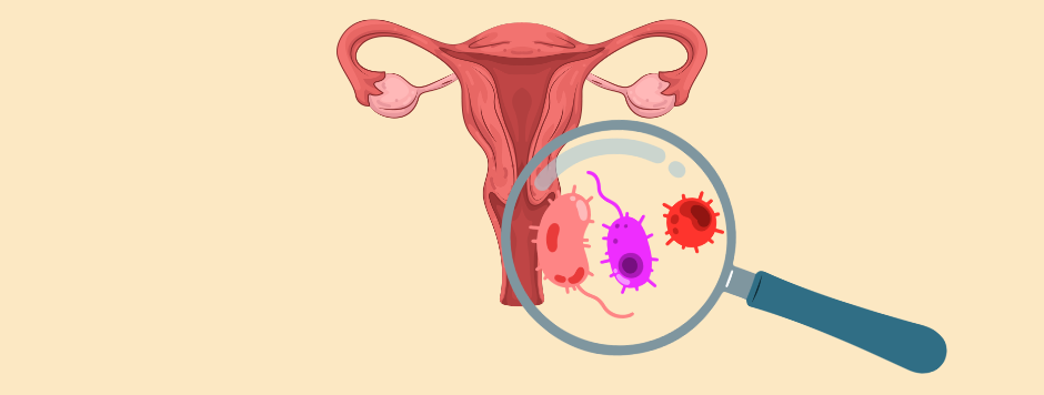 Lactobacillus de la flore vaginale