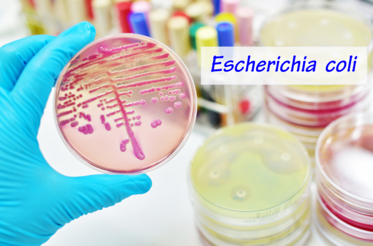 e. coli, kólibaktérium, kóli baktérium, kóli baktérium a vizeletben, escherichia coli, e coli baktérium kiírtása, coli baktériumok, e coli baktérium székletben, e coli fertőzés kezelése, escherichia coli baktérium, escherichia coli fertőzés, escherichia coli jelentése, e coli, coli baktérium, e coli baktérium kiírtása, e coli baktérium, coli e
