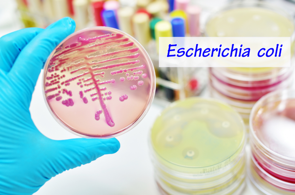 e. coli, kólibaktérium, kóli baktérium, kóli baktérium a vizeletben, escherichia coli, e coli baktérium kiírtása, coli baktériumok, e coli baktérium székletben, e coli fertőzés kezelése, escherichia coli baktérium, escherichia coli fertőzés, escherichia coli jelentése, e coli, coli baktérium, e coli baktérium kiírtása, e coli baktérium, coli e