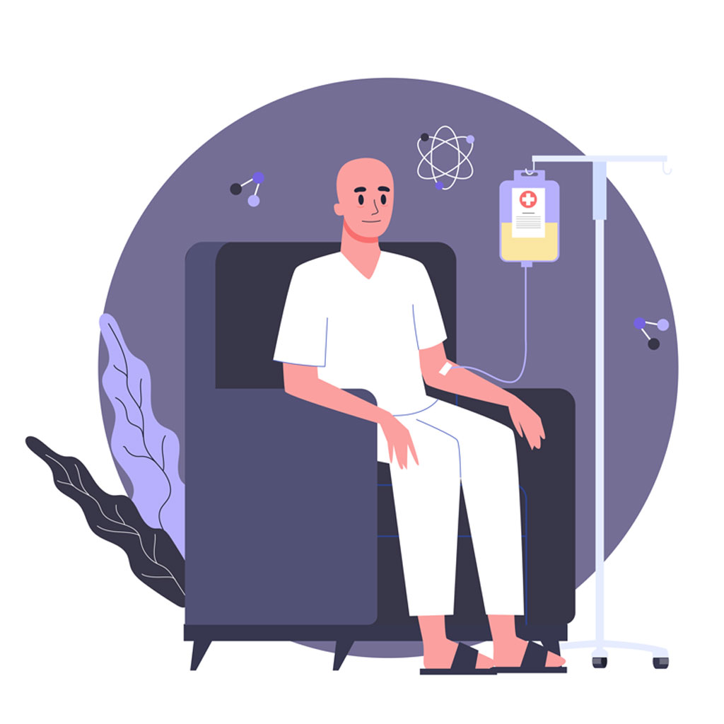 Daganatos betegség, probiotikum, székrekedés, szorulás, szorulás ellen, melyik probiotikum