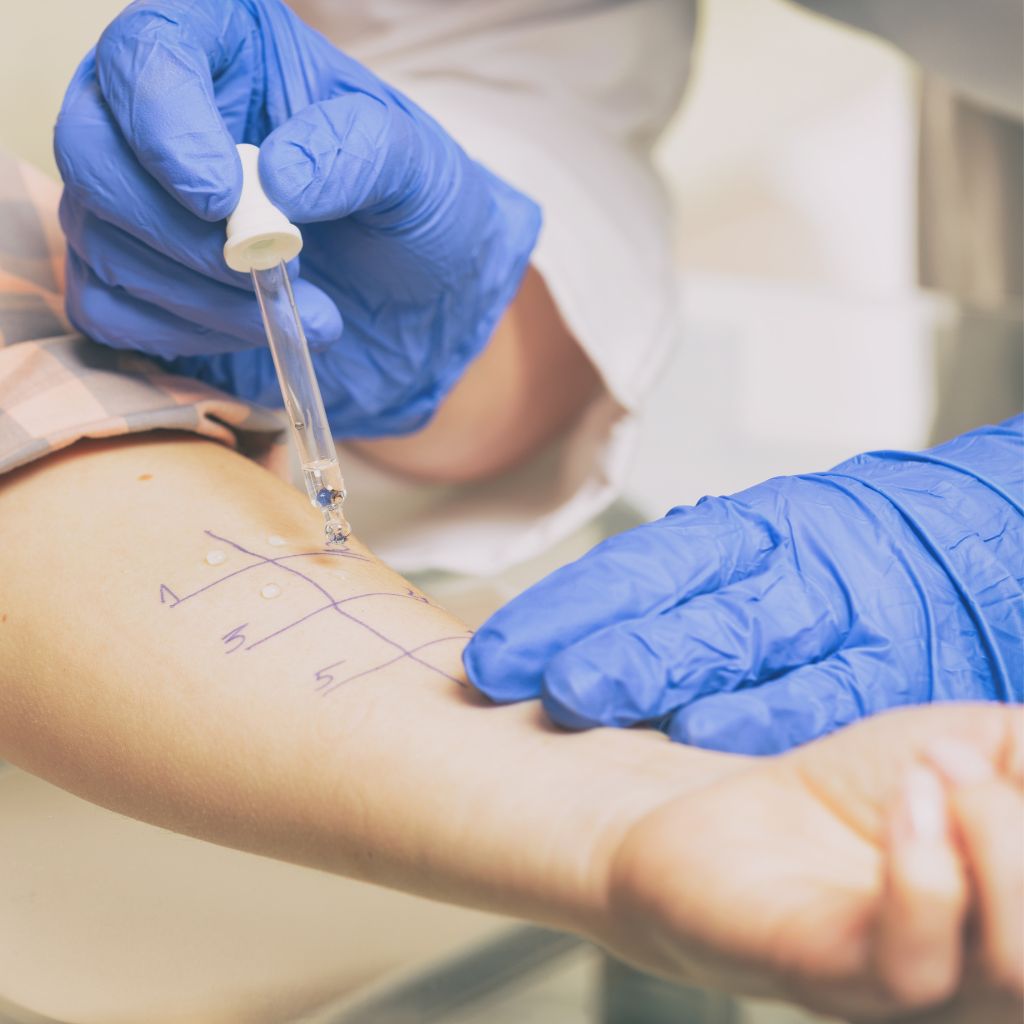 Allergietest - haben alle Allergien mit dem Darm zu tun?