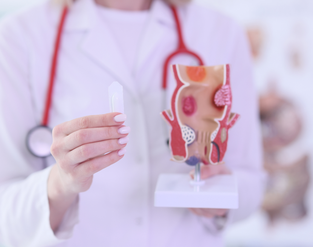 ako vyzeraju hemoroidy