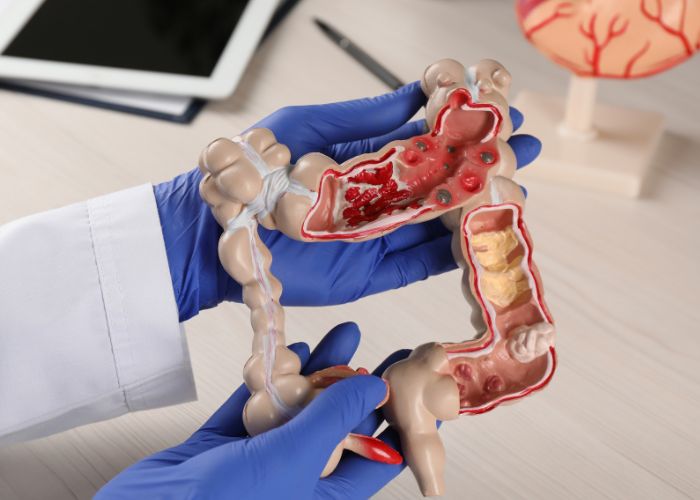 podpora crevnej flory pri uzivani antibiotik