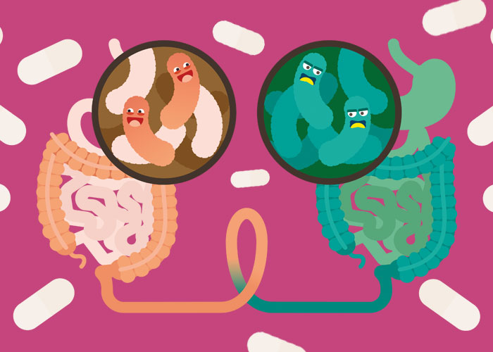 transplatnacia stolice