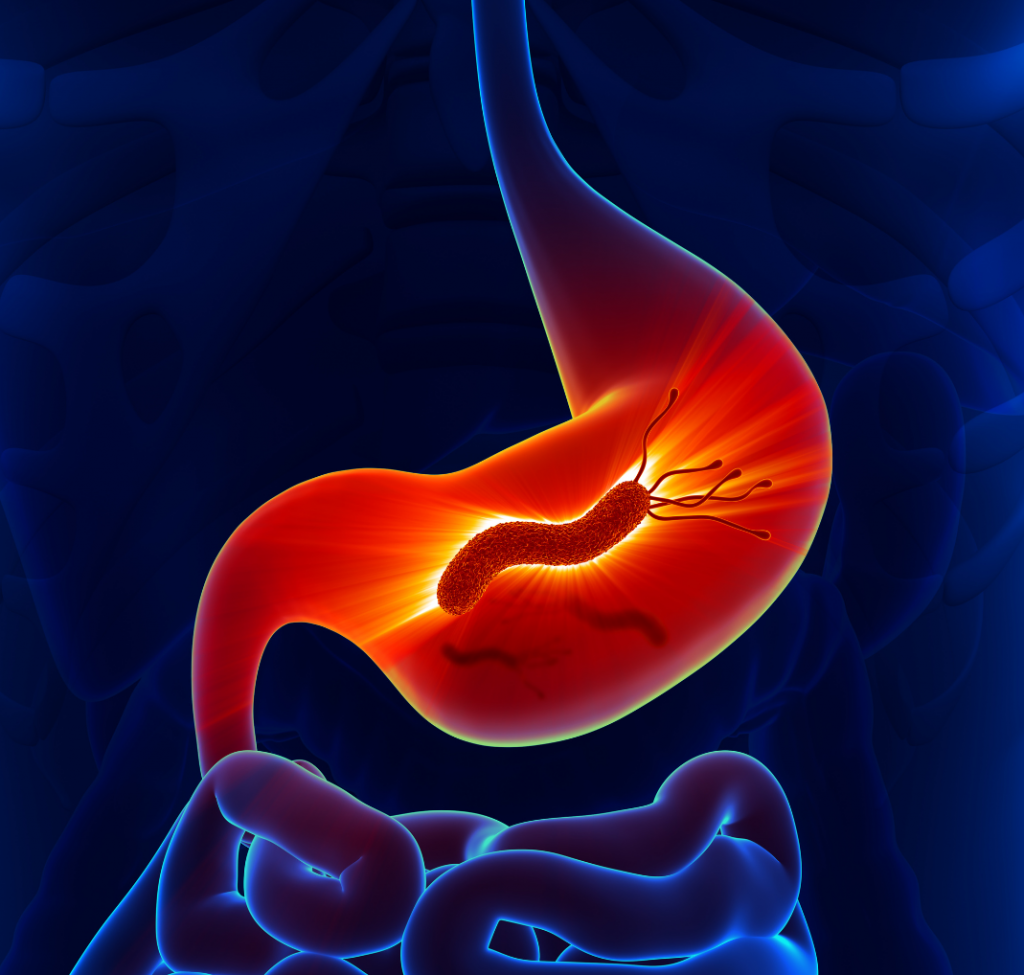 helicobacter pylori priznaky