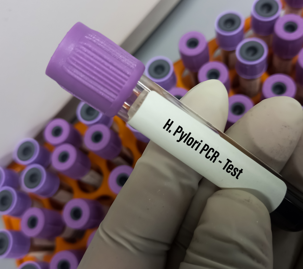 helicobacter pylori test