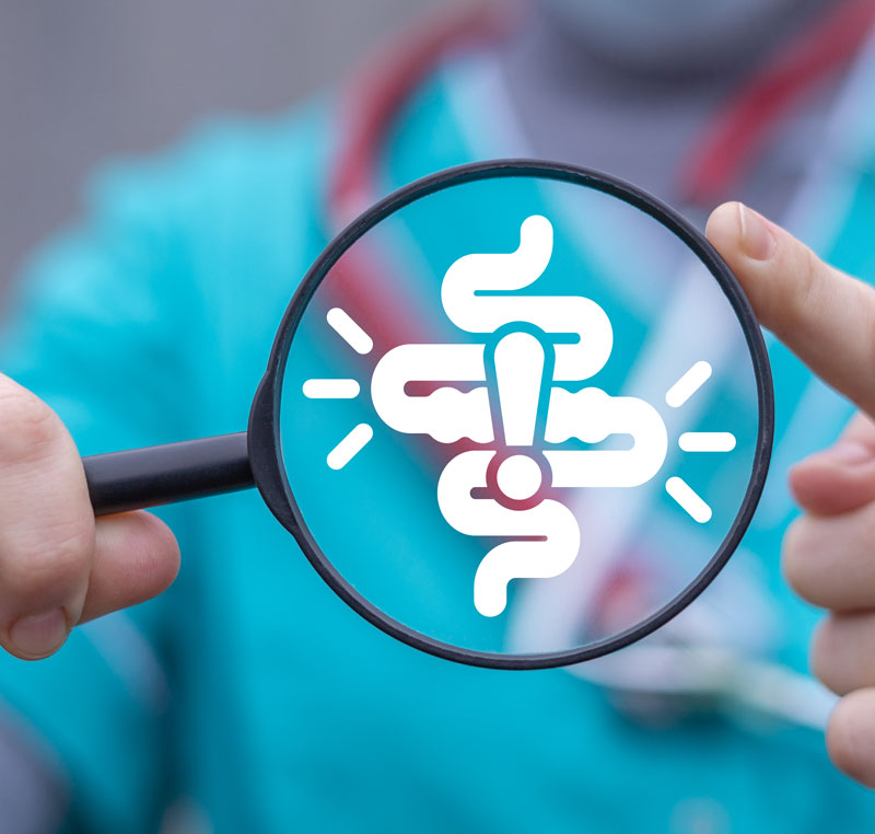 vzroki za nastanek ibs